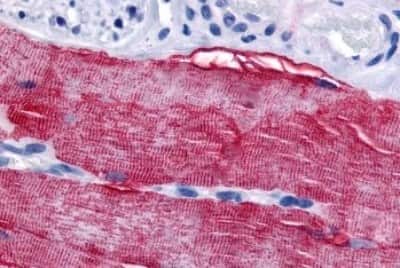 Immunohistochemistry-Paraffin: GRK5 Antibody [NBP3-14367] - Immunohistochemistry of formalin-fixed, paraffin-embedded human skeletal muscle after heat-induced antigen retrieval.